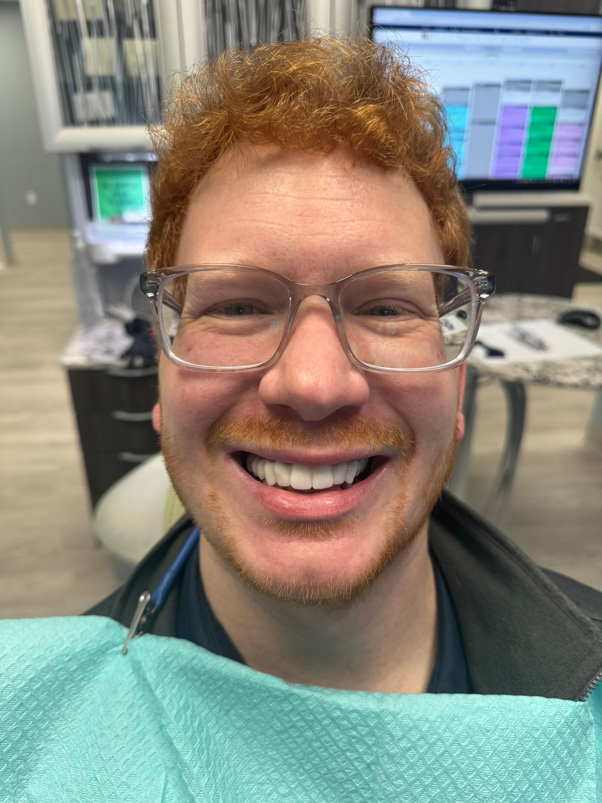 Mono Implant Case 11 - After