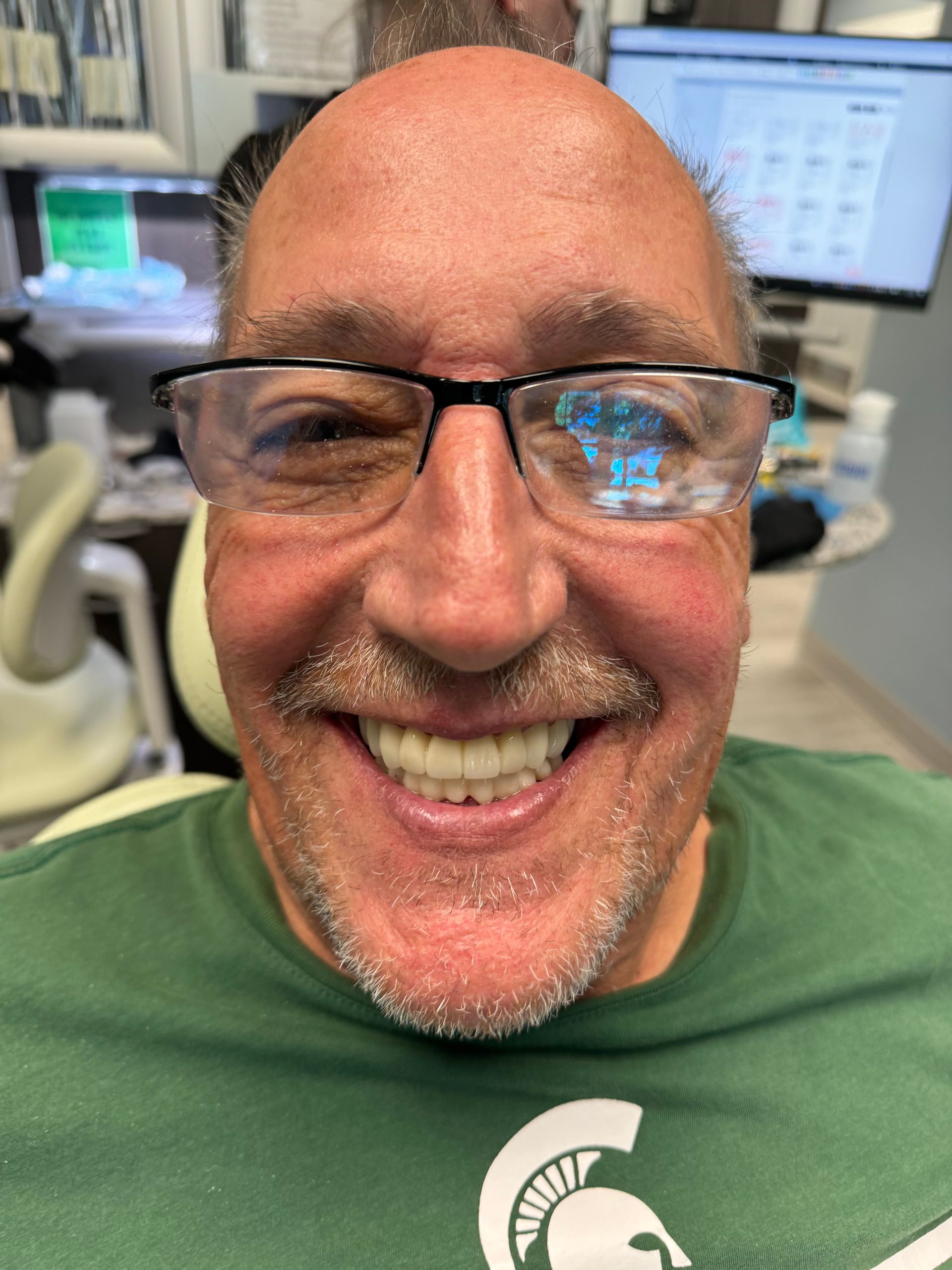 Mono Implant Case 10 After