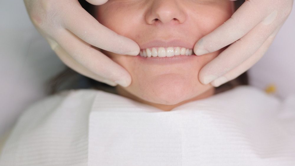 detal crowns