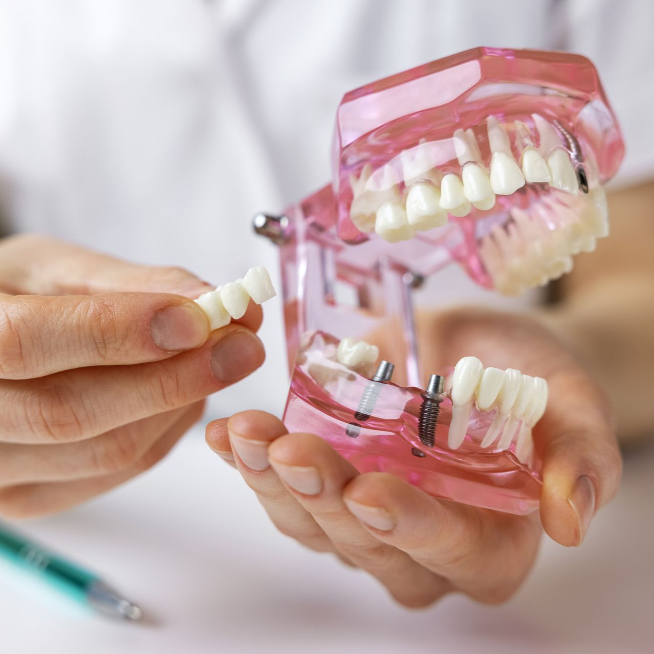 8 to 8 Dental | Lynnwood | Seattle | Arlington — Dental clinic in Lynnwood, WA — photo 4