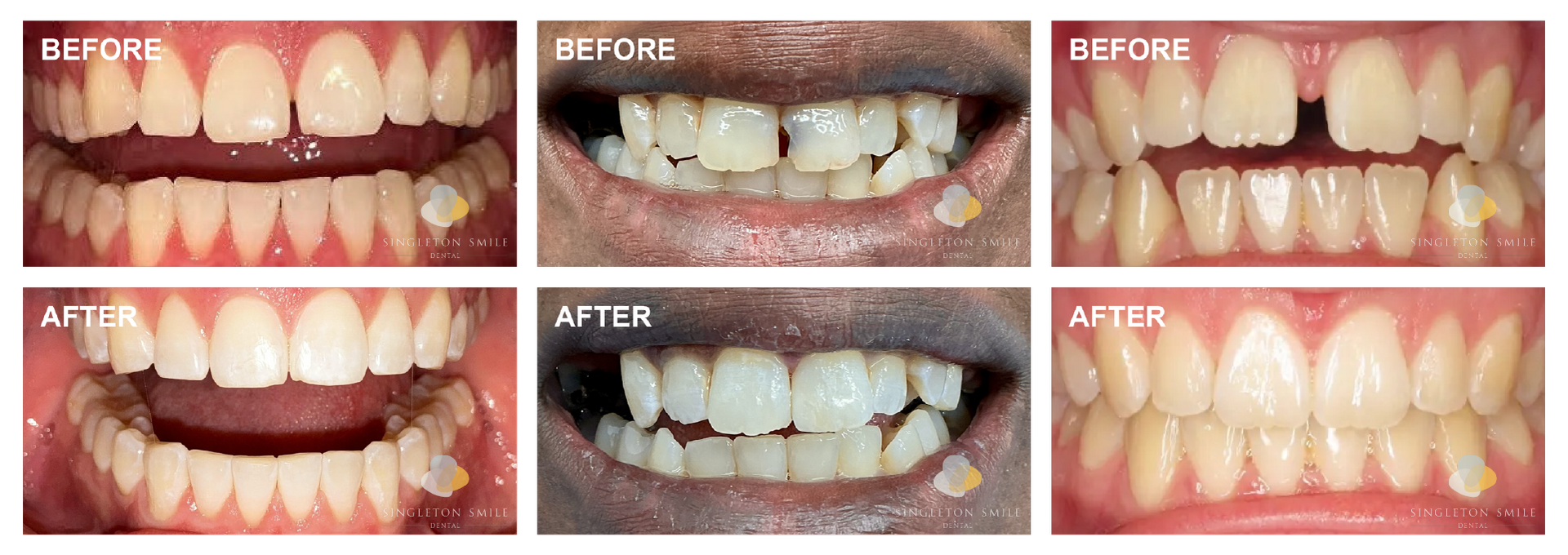 Before and After 2