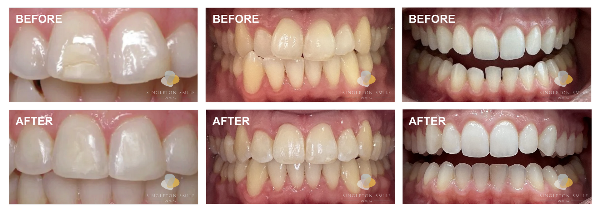 Before and After 3