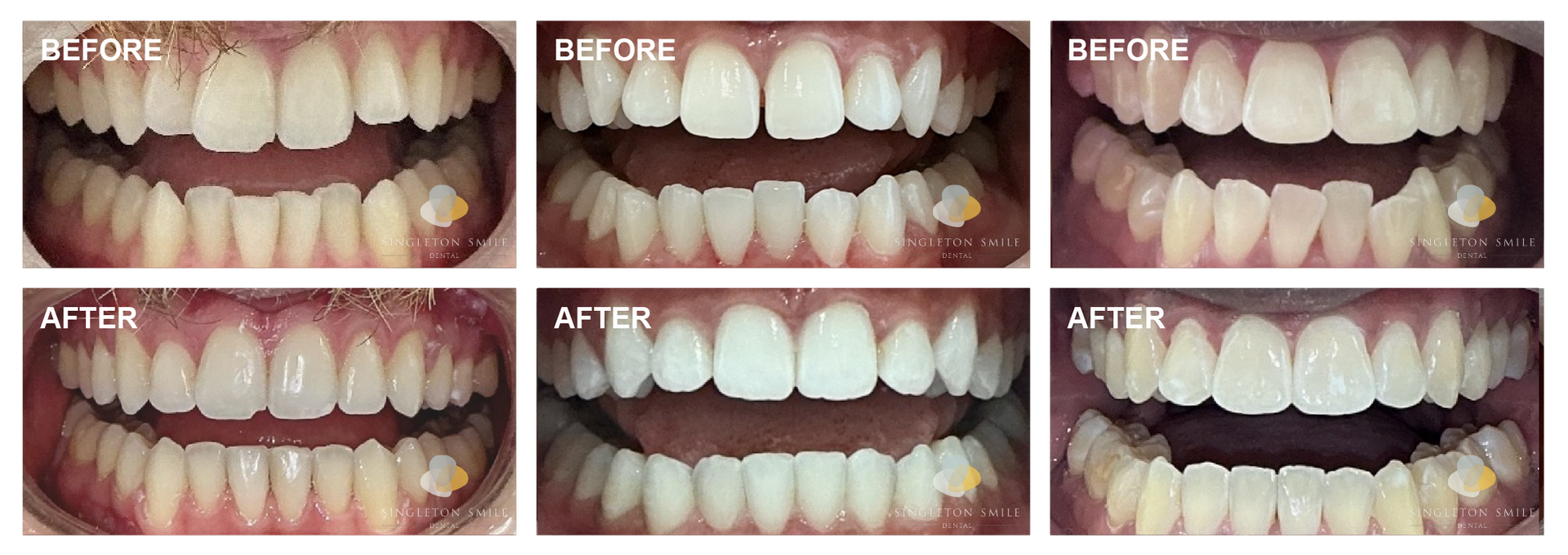 Before and After 4
