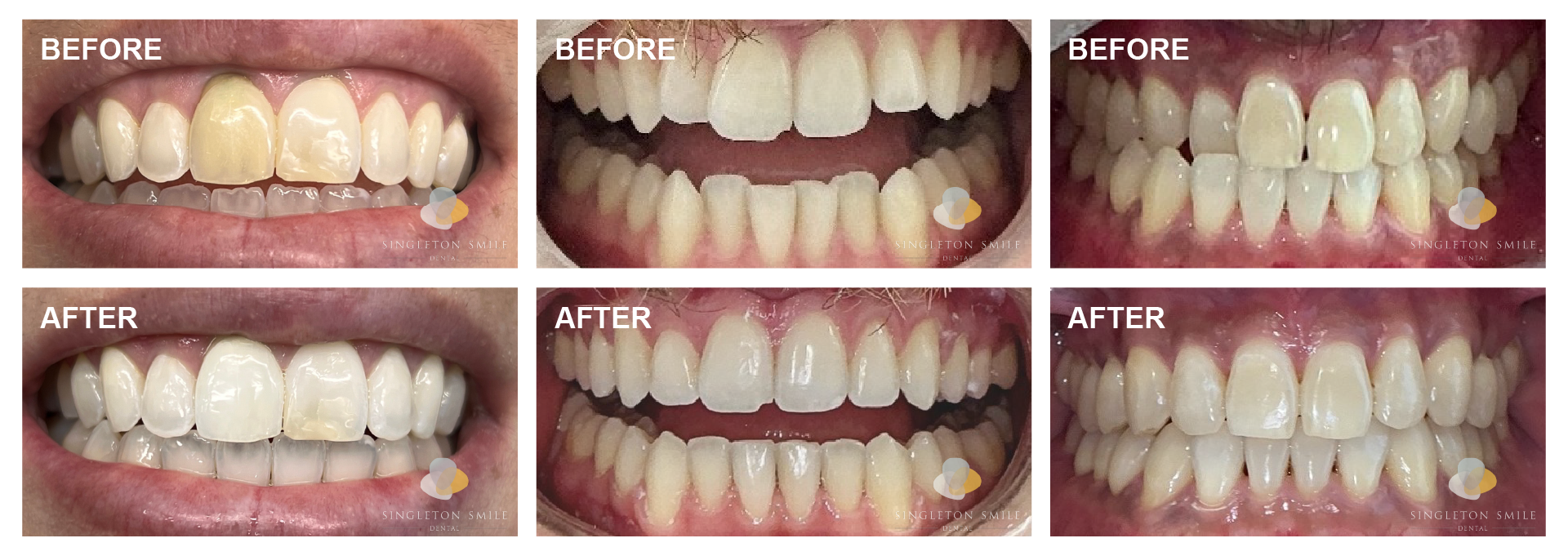 Before and After 5