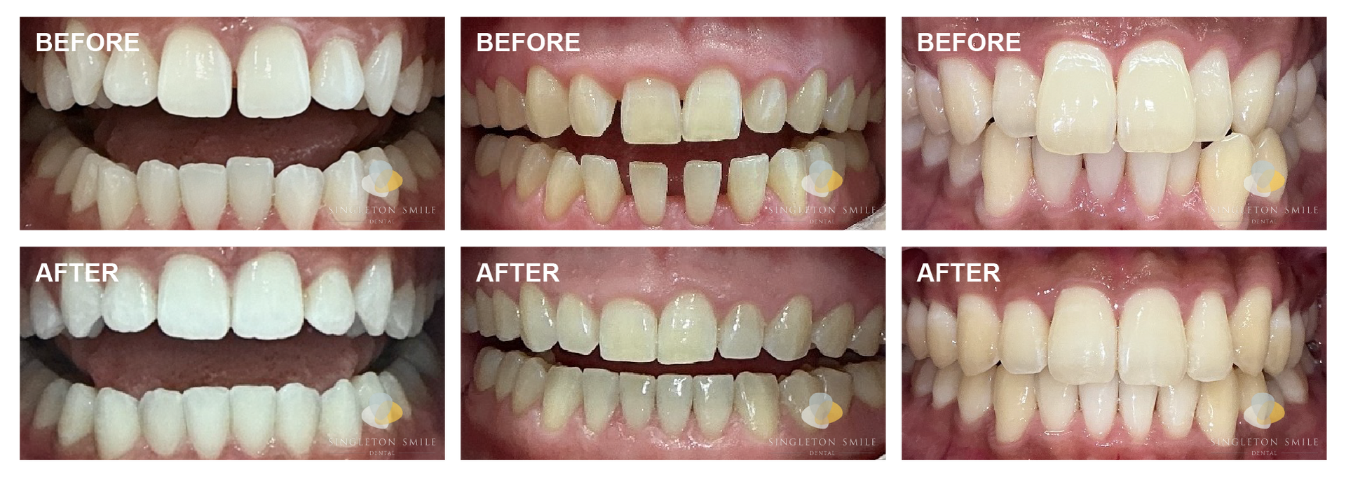 Before and After 6