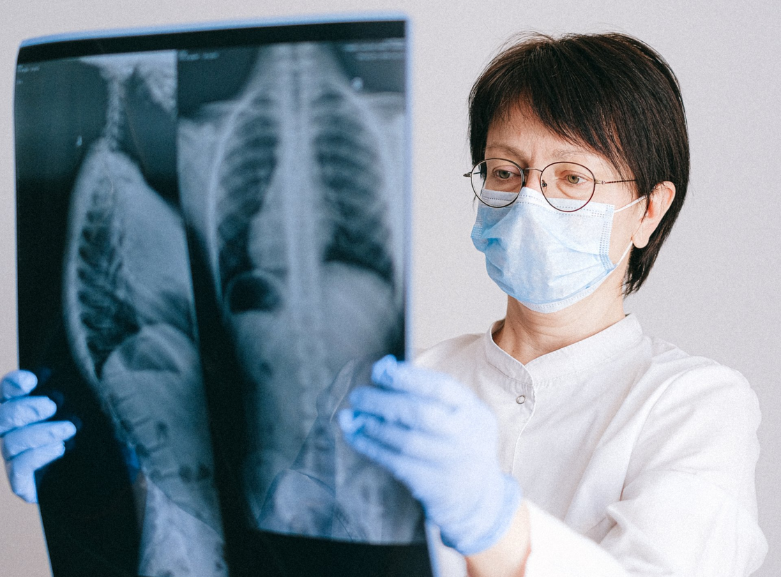 Doctor in mask and gloves examining chest X-ray.