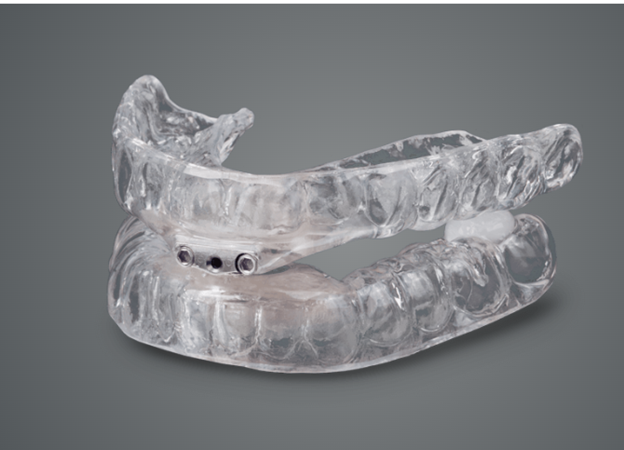 A clear mouth guard is sitting on a gray surface.