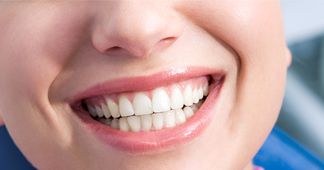 Woman Smiling With Bright, Straight Teeth