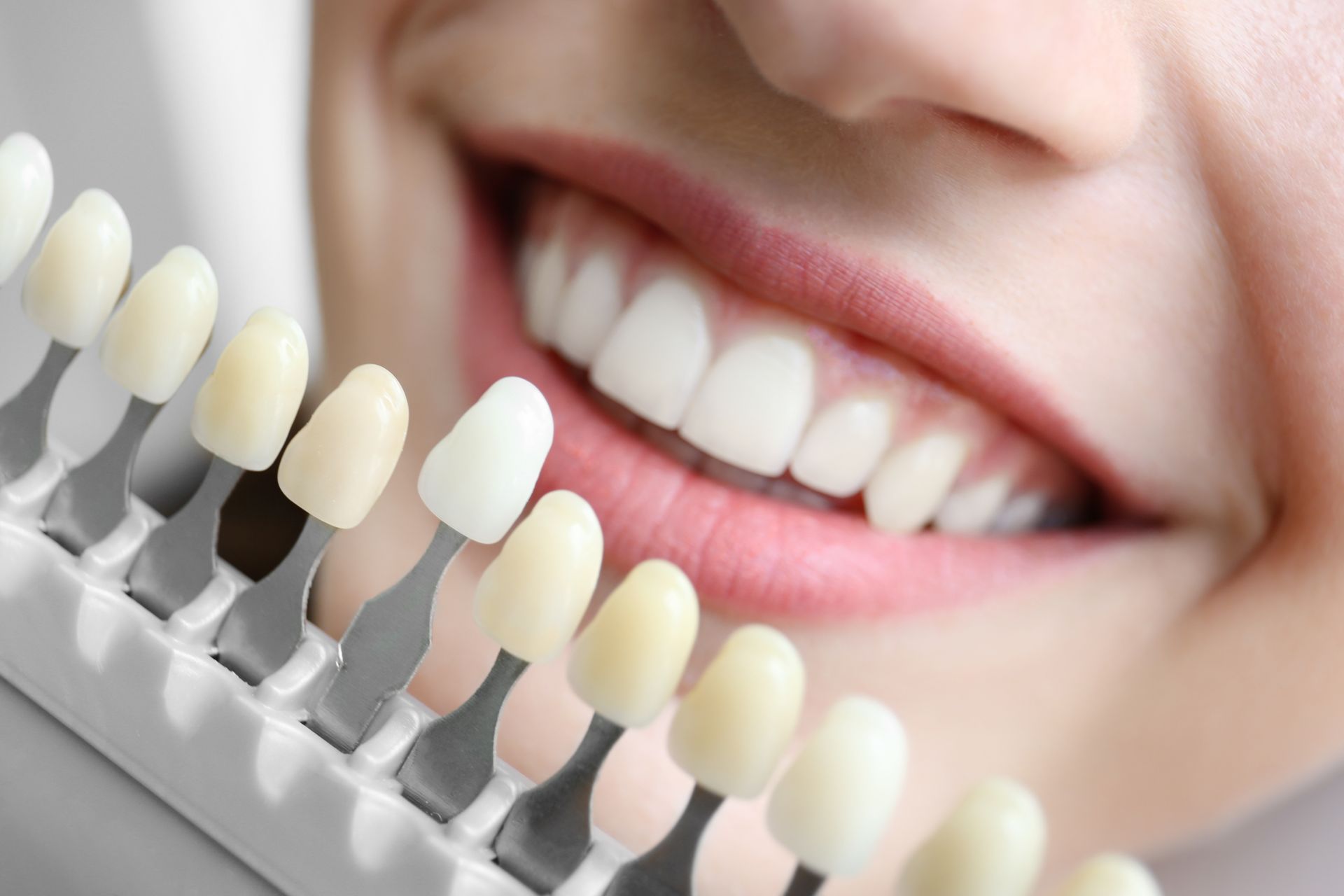 Smiling mouth beside a shade guide for teeth whitening.