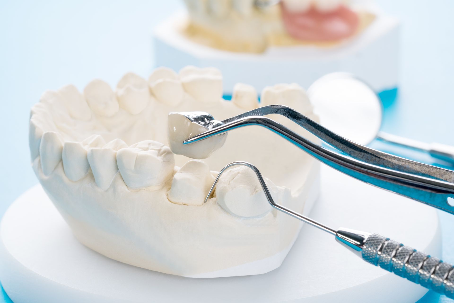 Dentist tools working on a white dental model in a bright clinic setting.