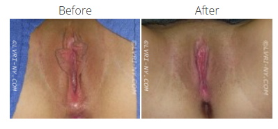 Comparison of