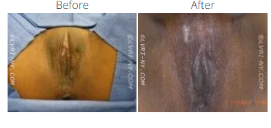 Comparison of
