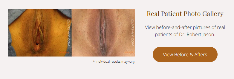 Before and after photos of a patient's genitals. Text: