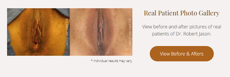 Before and after photos of a surgical procedure, with text