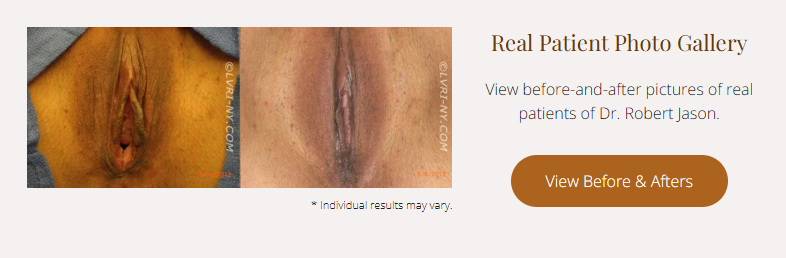 Before and after images of a medical procedure with text that reads