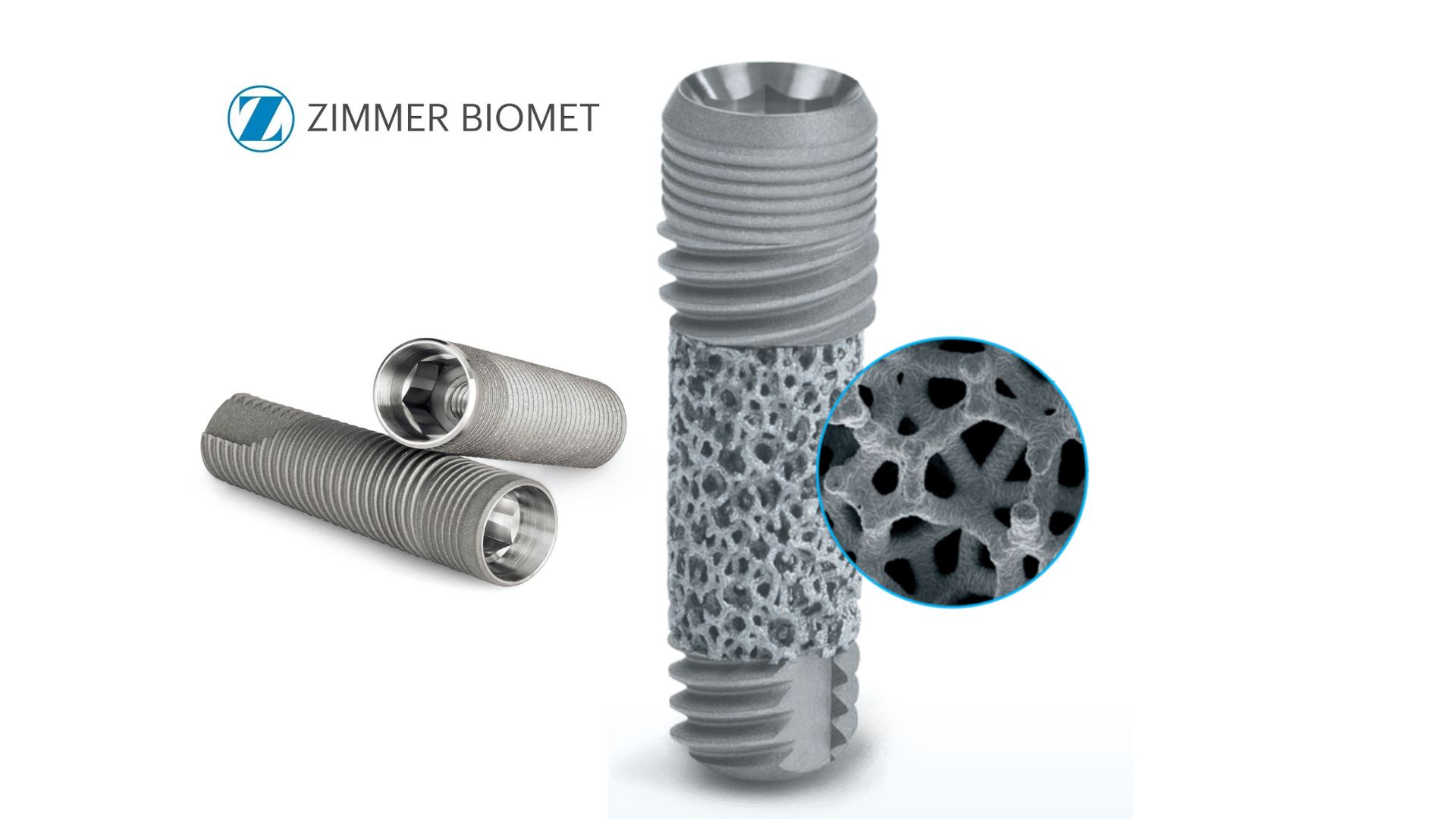 Review of Best Dental Implant Systems