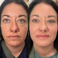 Before-and-after close-up portraits of a woman, showing bare skin on the left and makeup on the right.