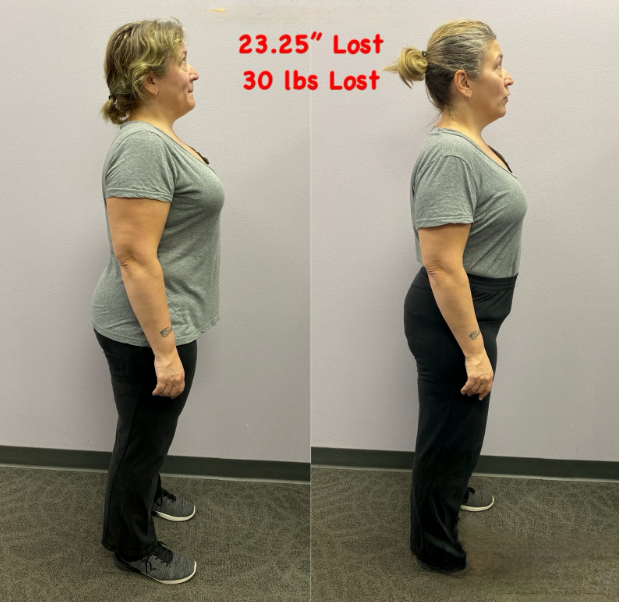 A before and after photo of a woman who lost 30 lbs