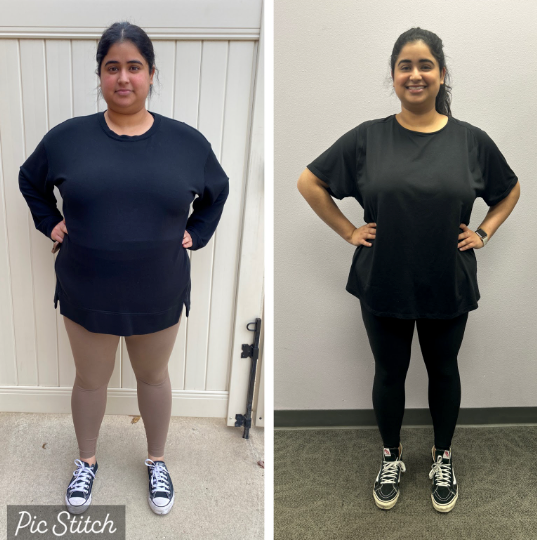 A picture of a woman before and after losing weight