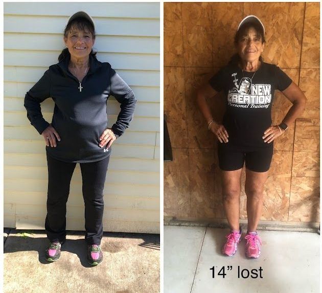 A before and after photo of a woman wearing a new operation shirt