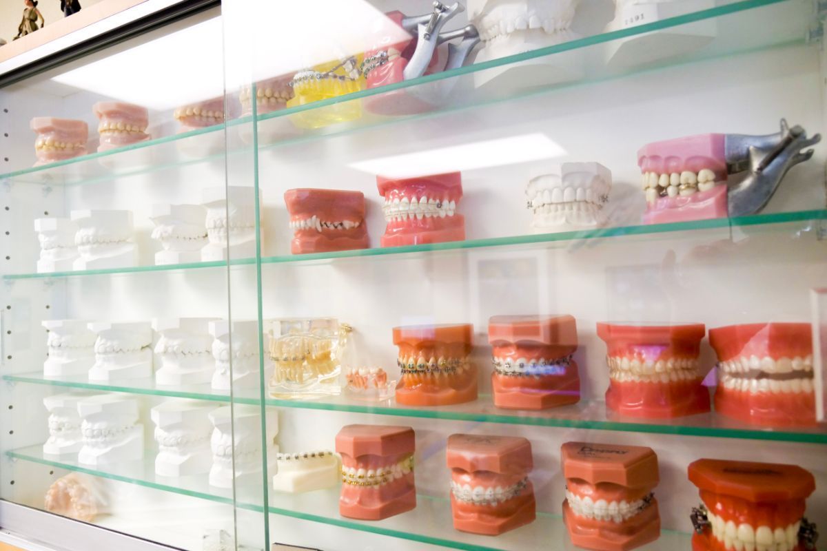 Glass shelves displaying rows of dental models and braces in a clinic showroom