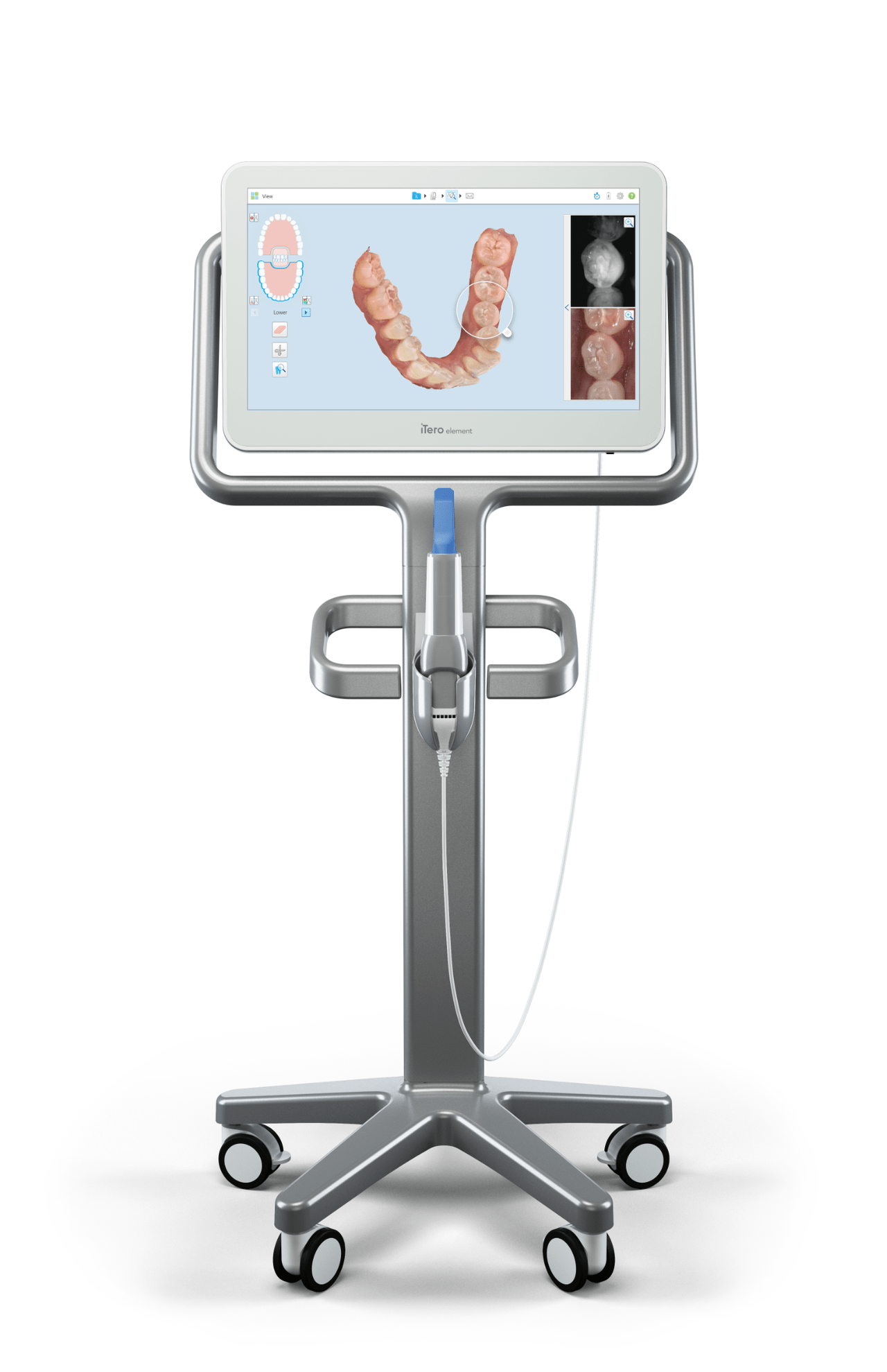 iTero Element 5D digital scanner used at Brodsky Orthodontics