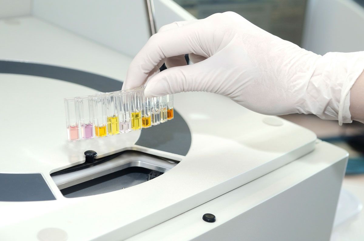 Hematuria, sangre en la orina