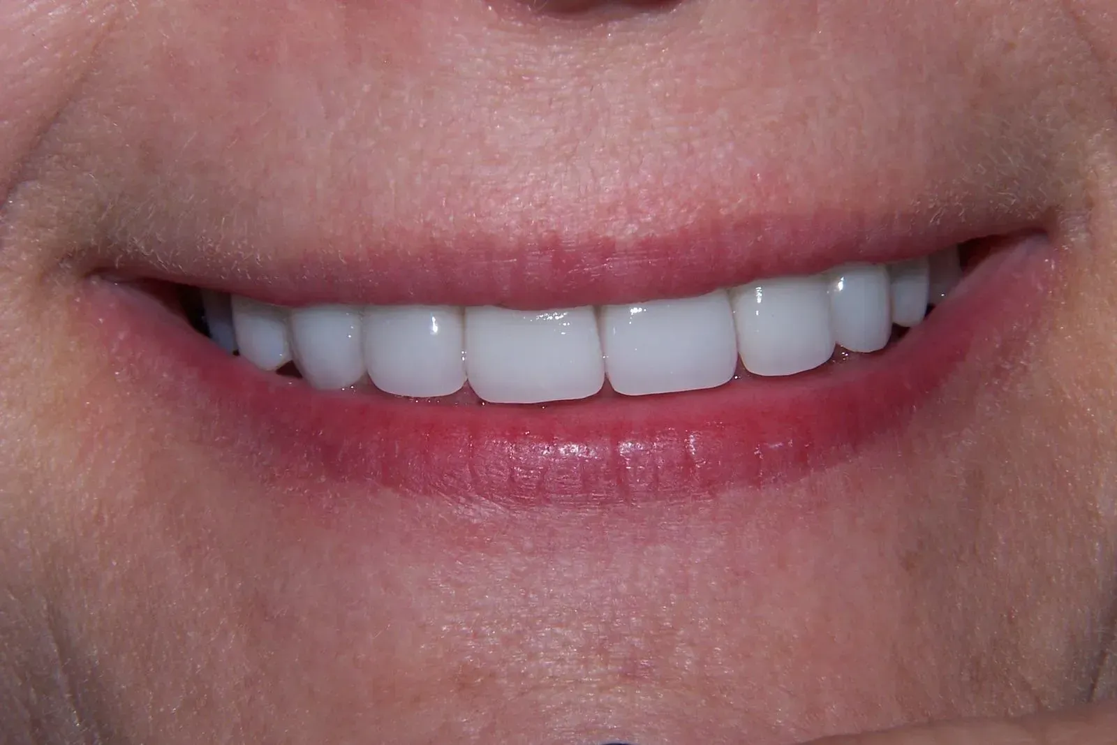 A close up of a woman 's smile with white teeth and red lips.