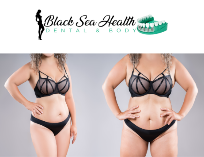Logo for Black Sea Health Dental & Body above two side-by-side photos of the same person in black lingerie.