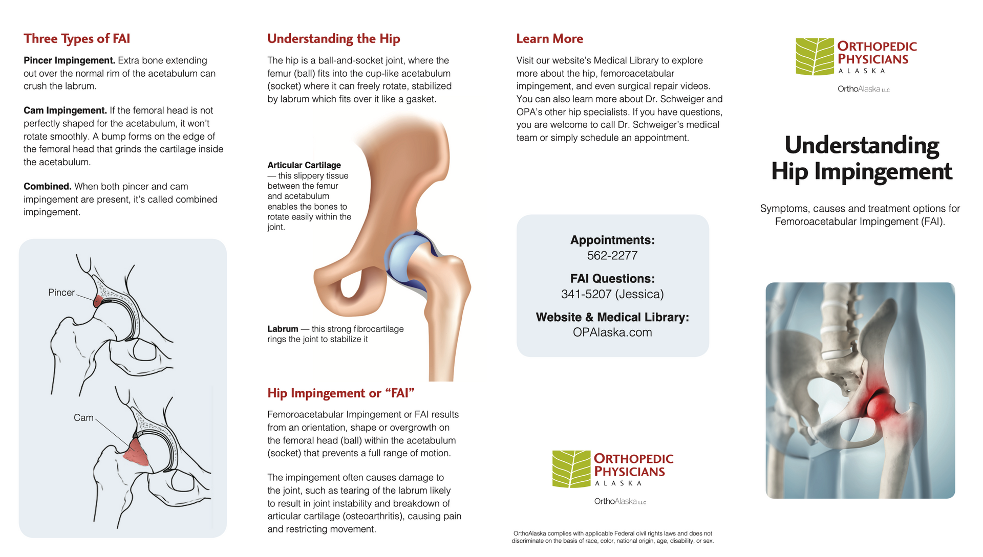 Copywriting sample educating patients about hip impingement.