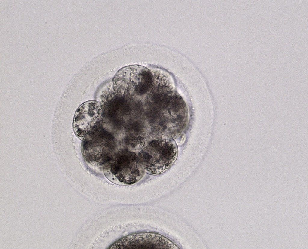 Good quality day 3 embryo.