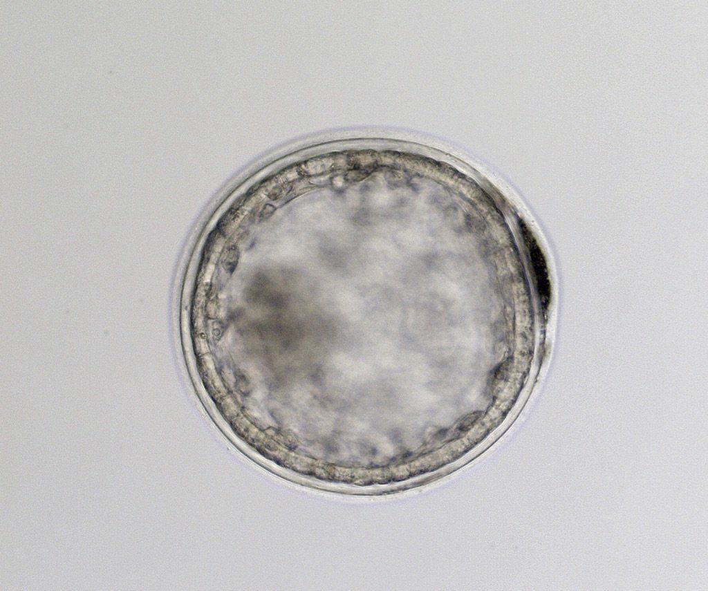 Expanded blastocyst, 300 microns