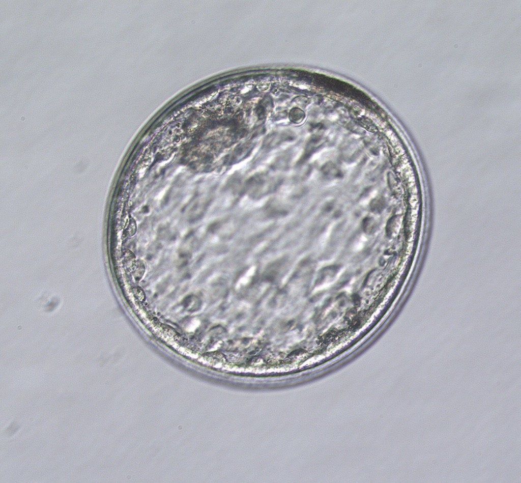 Grade 1 expanded blastocyst