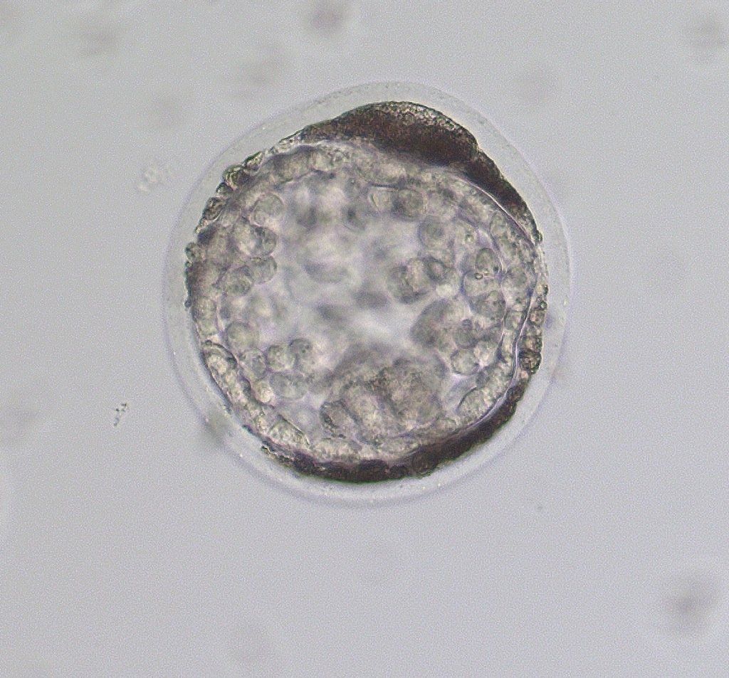 Grade 2 expanded blastocyst