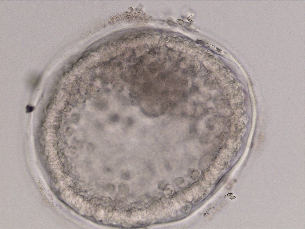 Grade 3 expanded blastocyst