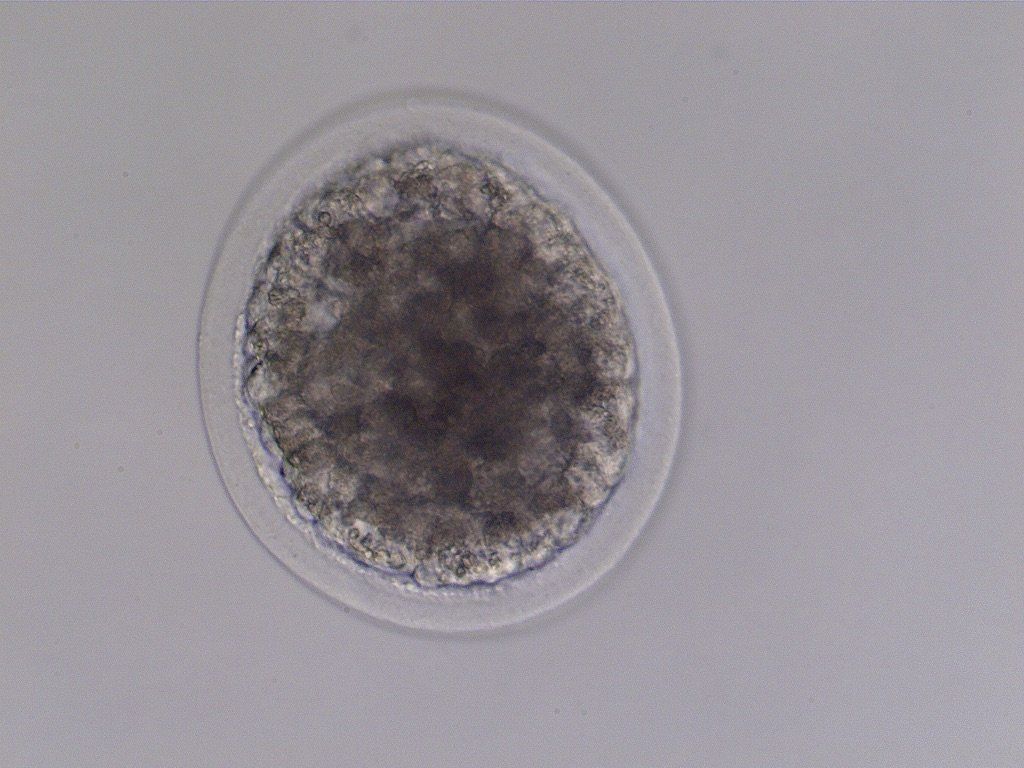 Morula, 160 microns.