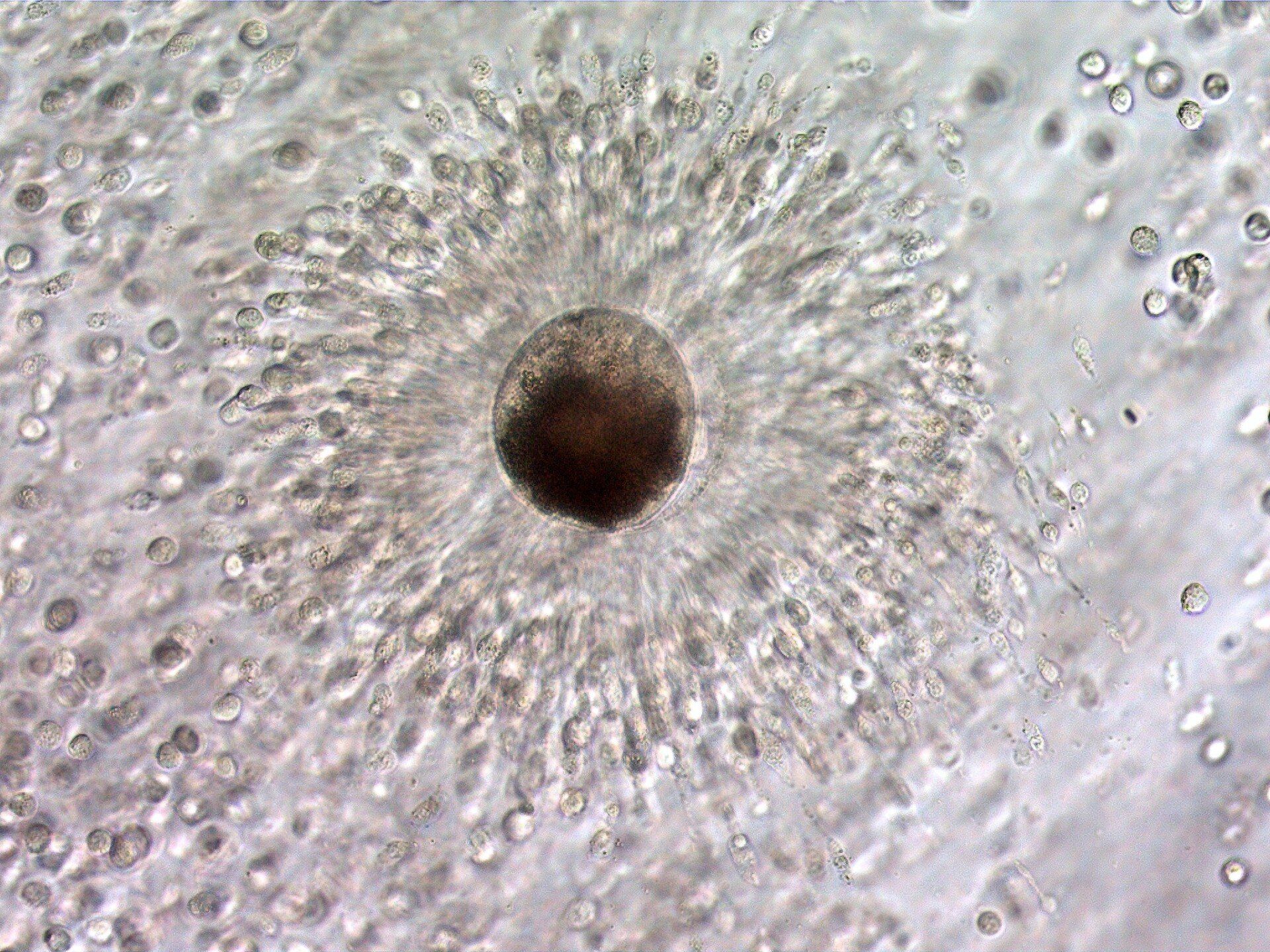 Mature oocyte in an expanded cumulus mass. The cumulus cells directly around the oocyte function to nourish the oocyte and maintain its environment, and is called the corona radiata.