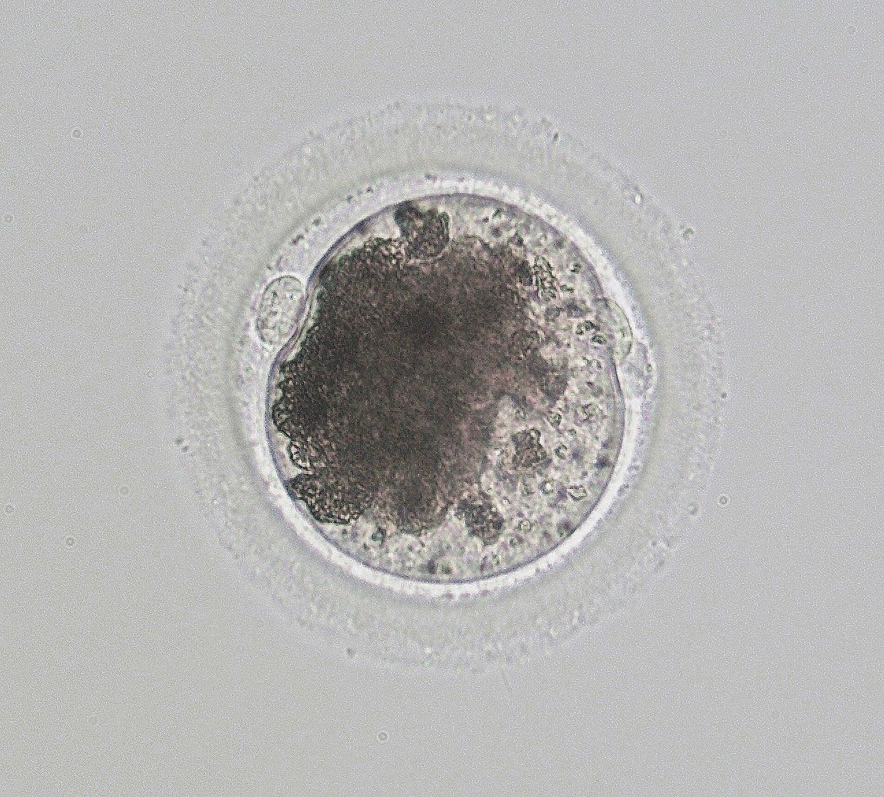 Second Polar Body Extrusion
