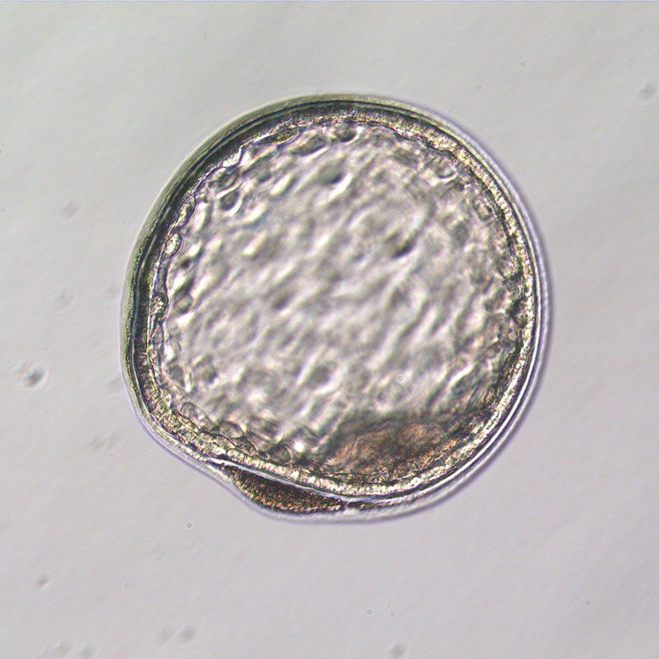 Embryo Transfer