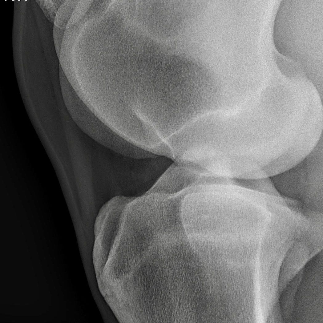 Equine Medical Services utilizes both portable and in-house digital radiography to provide high-quality images for complete evaluation of musculoskeletal conditions.