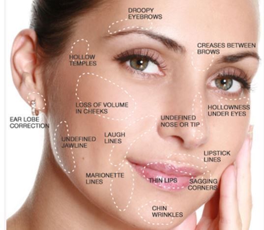 Cosmetic Fillings