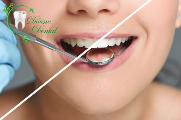 Smile Makeovers Teeth Whitening Scottsdale
