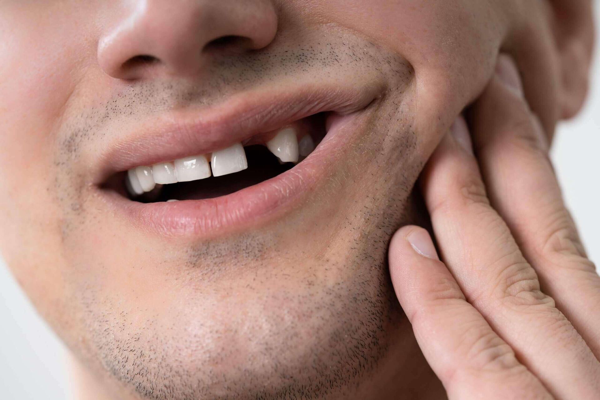 Knocked Out Tooth