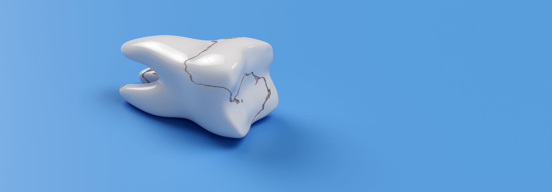 Treatment for Fractured or Broken Teeth