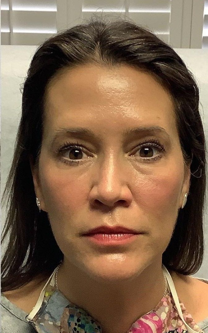Woman looking at the camera, wearing light makeup, with slight blush.