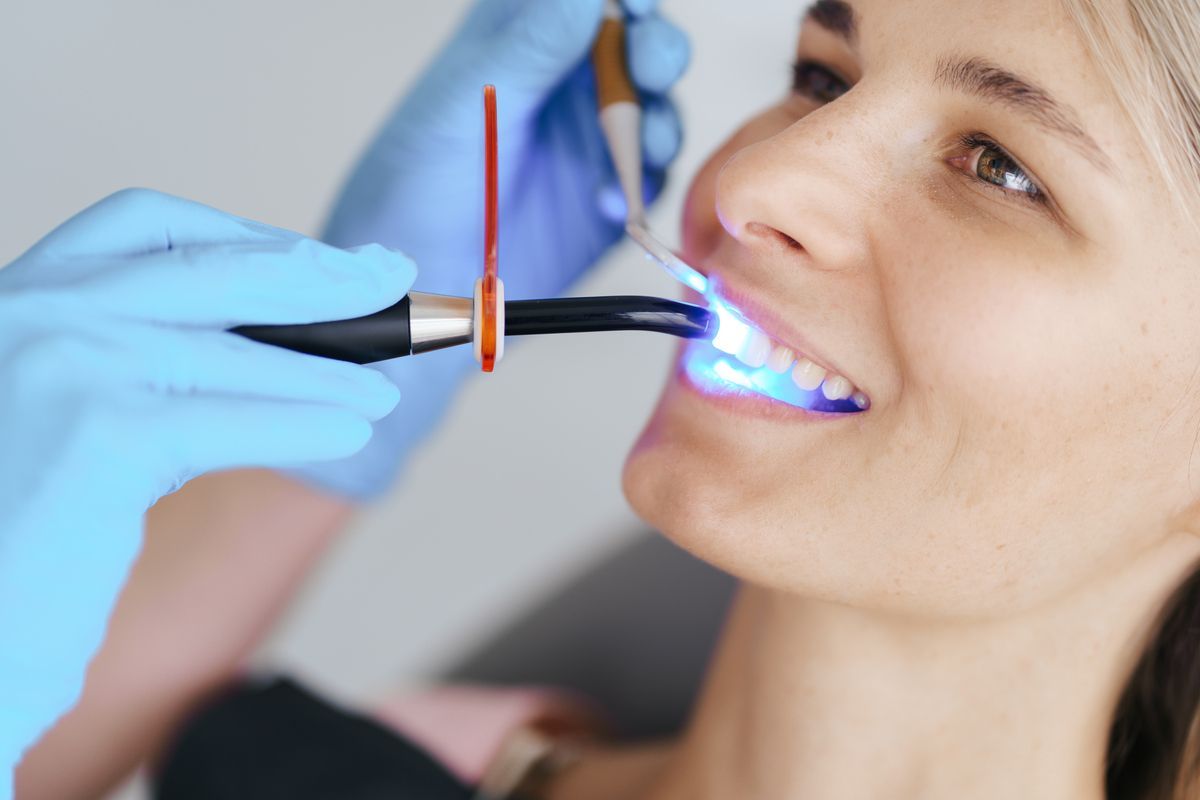 Dentist applying blue curing light to a smiling patient’s teeth