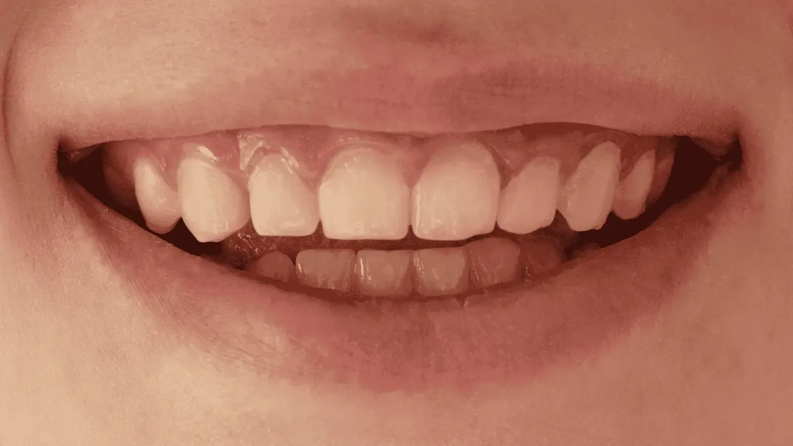 A close up of a person 's mouth with their teeth showing.