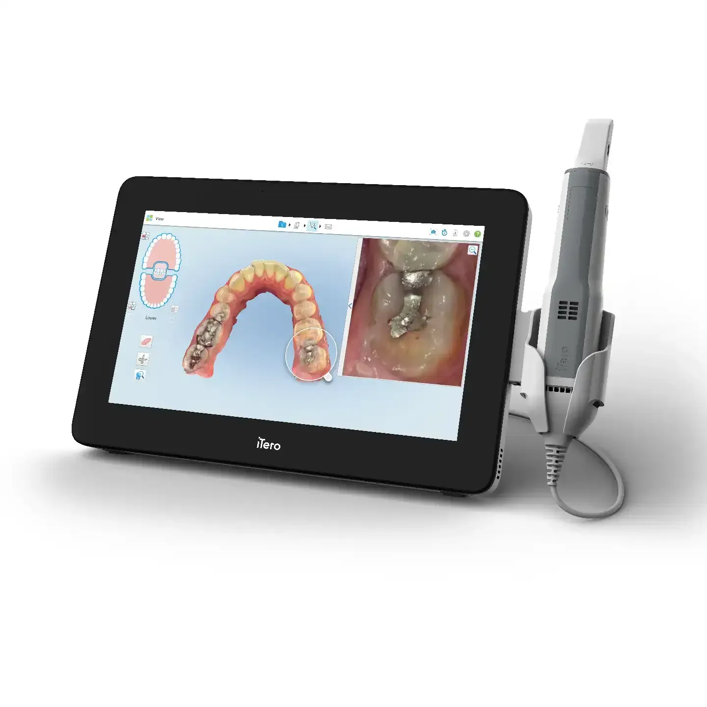 iTero Dental Scanner
