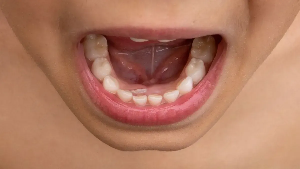 Mouth wide open, showing lower and upper teeth; pink lips.