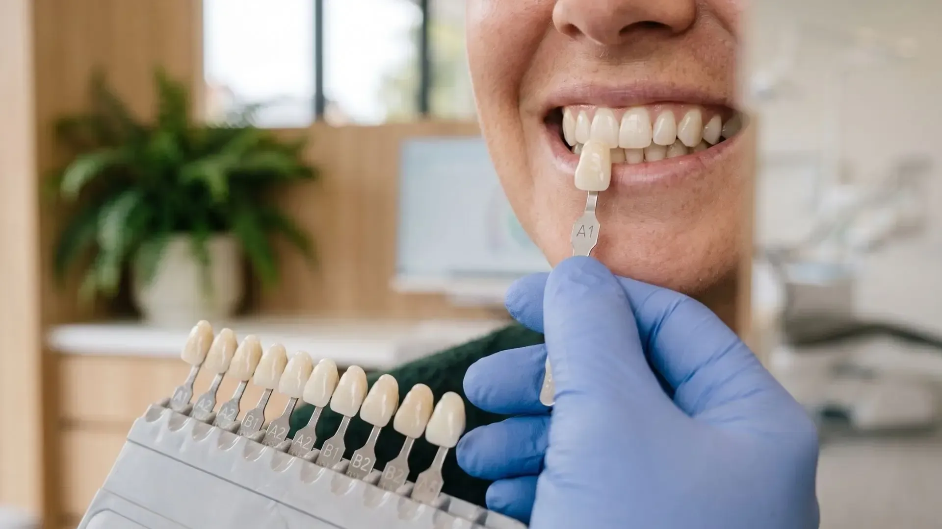 Dentist in blue gloves matching a tooth shade to a patient’s front teeth with a shade guide